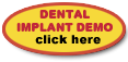 dental implant demo
